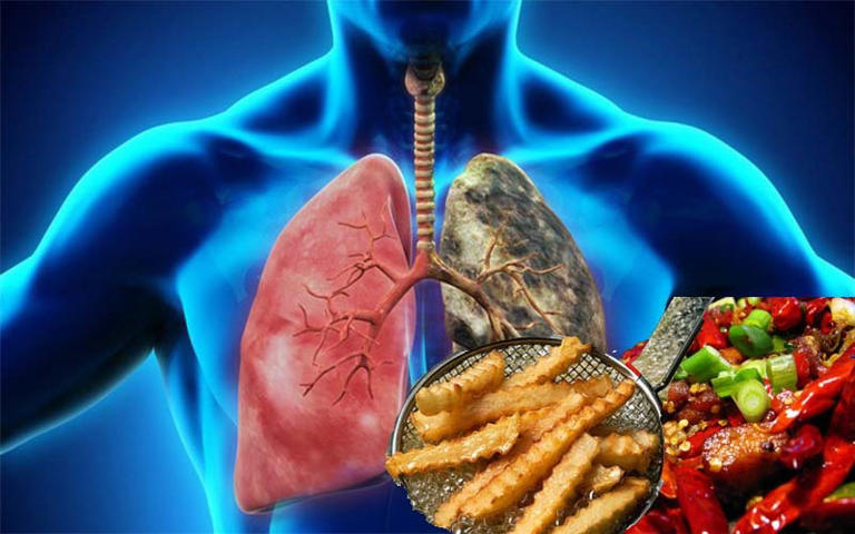 5 loại thực phẩm gây hại cho phổi