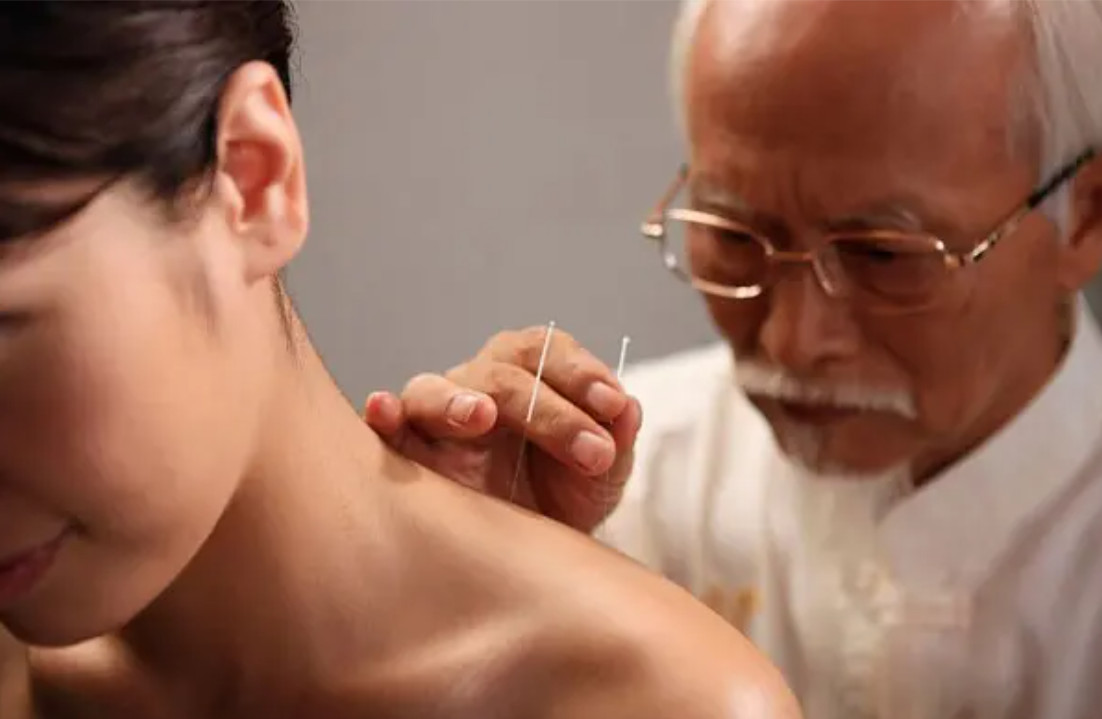 Điều trị thoát vị đĩa đệm bằng châm cứu có mang lại hiệu quả không?