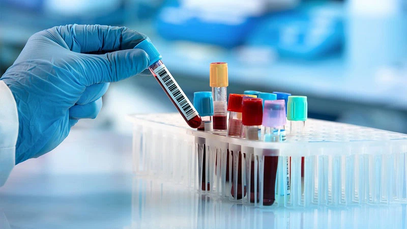 Tranh cãi xét nghiệm máu giúp phát hiện sớm 50 loại ung thư