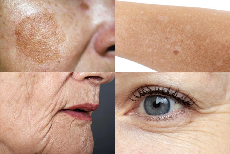 Những thành phần chăm sóc da để ngăn quá trình lão hóa