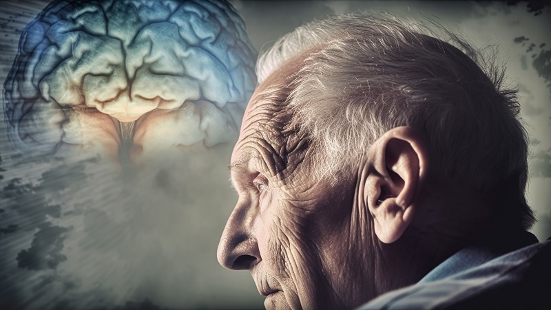 Alzheimer – bệnh liên quan gene di truyền